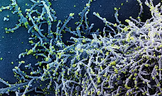 China deve aprovar 1º. medicamento contra o vírus em dezembro
