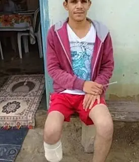 Homem amputa o próprio pé para receber seguro