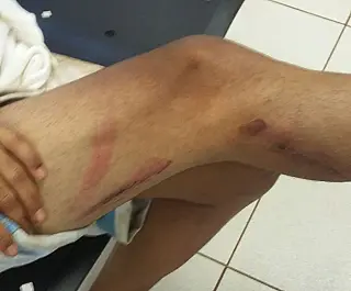 Ex-vereador é acusado de tentar linchar homossexual