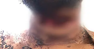 Homem que foi enterrado vivo com corte no pescoço recebe alta médica