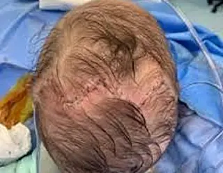 Estado paga meio milhão para corrigir má formação craniana