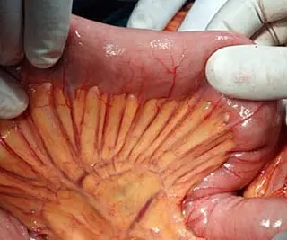 Cientistas descobrem novo órgão do corpo humano