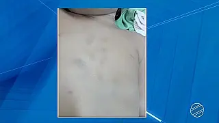 Polícia investiga maus tratos em caso de criança morta em Corumbá