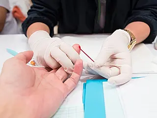 Combate a sífilis terá Dia D terça-feira em Dourados