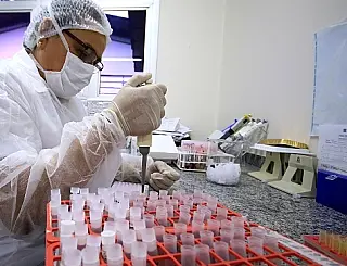 Saúde garante que não há falta de kits para testes do corona no Estado