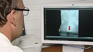 Criada em SC máquina que mede e elabora mapa da dor