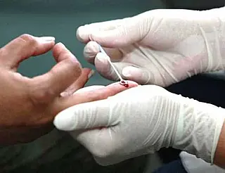 Saúde intensifica ações para reduzir casos de sífilis em Dourados