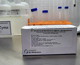 MS recebe material para diagnóstico da Monkeypox