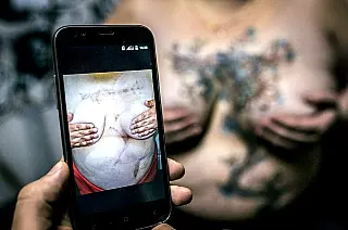 Para esconder cicatrizes da violência doméstica Russas fazem tatuagens