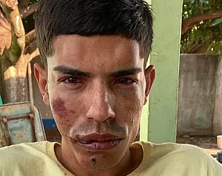 Homem que matou médico morre em Dourados