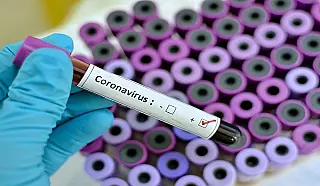 1.610 casos novos de Covid nas últimas 24 horas