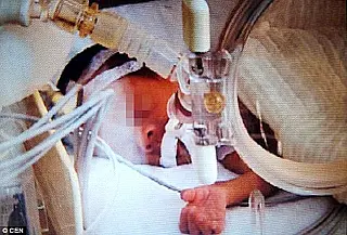 Bebê de um mês declarado morto se mexe pouco antes de ser cremado