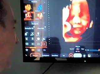 Bebê responde à voz do pai da barriga da mãe