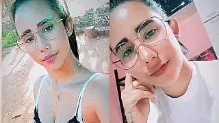 Jovem que teve infecção causada por piercing teve 5 paradas cardíacas