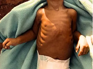 Criança indígena morre em acampamento