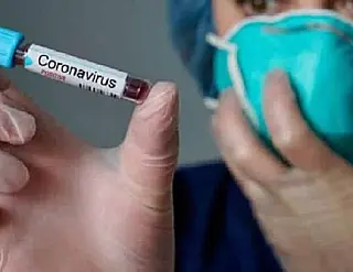 Funcionária da JBS é primeiro caso de Covid-19 na aldeia Jaguapiru de Dourados