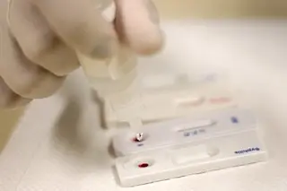 Plano para erradicar hepatite C até 2030 é apresentado pelo Brasil
