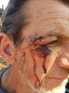 Indígenas invadem sítios em Dourados e agridem trabalhadores