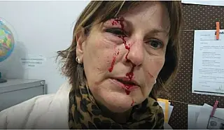 Acusado de dar soco em professora já teria agredido a própria mãe