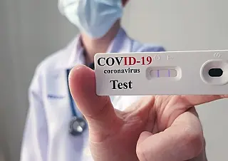 Vigilância Sanitária alerta para os cuidados com exames da Covid em farmácias da cidade