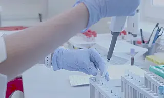 Novas linhagens da Ômicron avançam e favorecem reinfecções