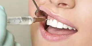 Decisão da Justiça muda regras para o uso de anestesia em consultórios dos dentistas