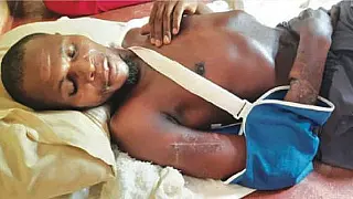 Homem sobrevive após lutar contra quatro crocodilos em lago na África