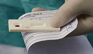 MS tem 273 novos casos de covid na última semana e três mortes registradas