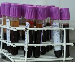 Campanha cadastra mais 33 doadores de medula óssea na UPA