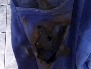 Celular explode em bolso de enfermeiro e causa queimaduras na perna