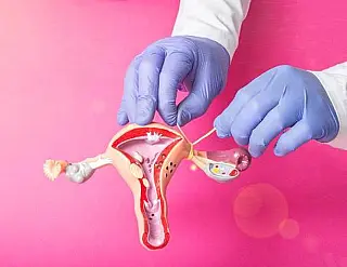 Novas regras para laqueadura e vasectomia