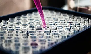 Pesquisas brasileiras avançam no diagnóstico de Alzheimer