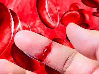 Dia Mundial da Hemofilia